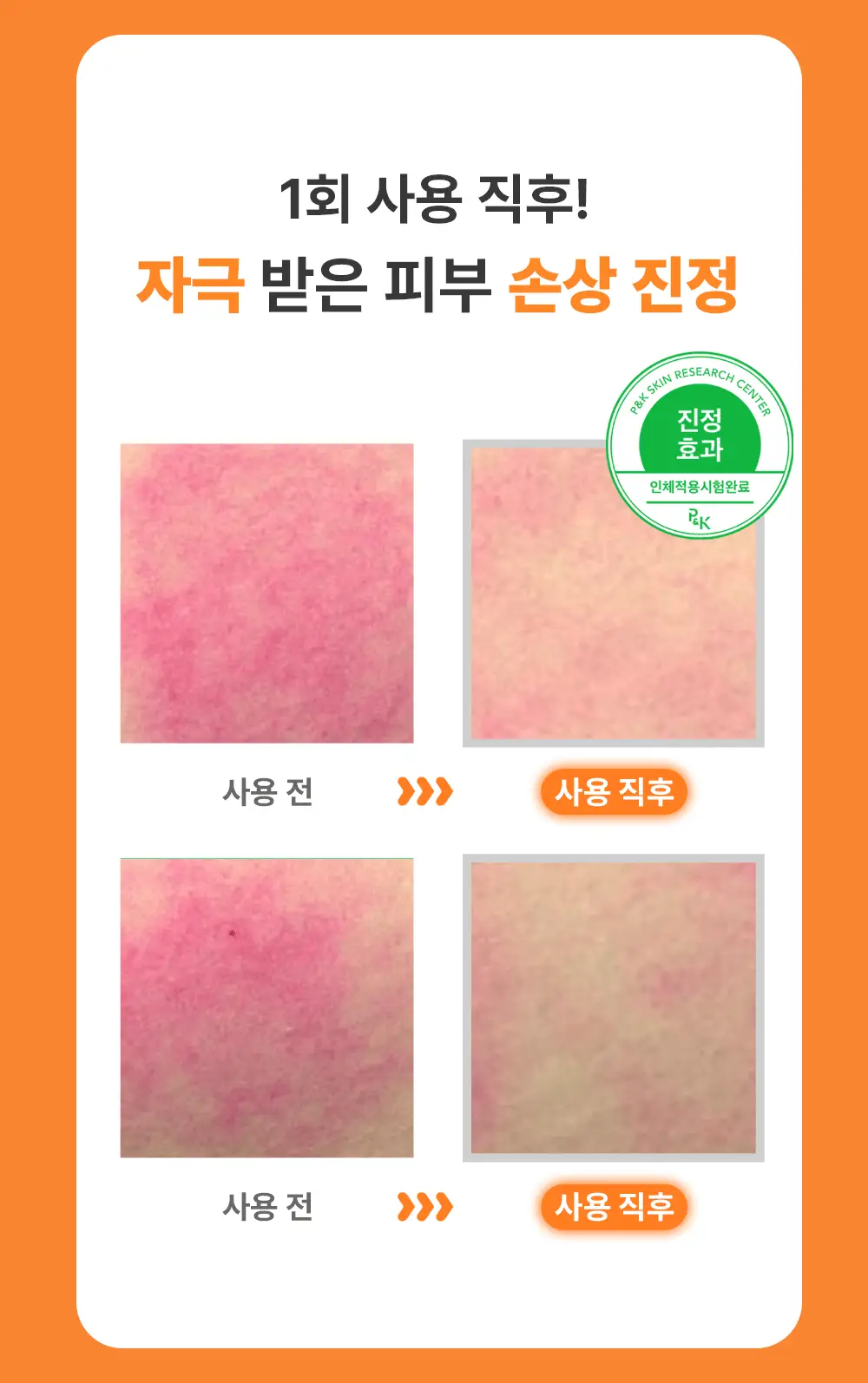 [열감진정] 이아이오 웰링 워시 오프 팩 110ml 기획 (+30g) 상세페이지 9